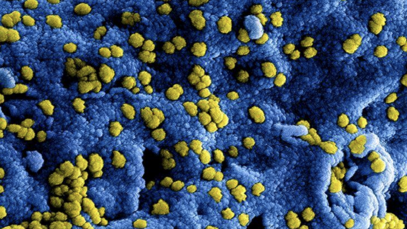 Update - 25 maart - Mogelijke afvlakking van aantal nieuwe ziekenhuisopnames van patiënten met coronavirus Update - 25 maart - Mogelijke afvlakking van aantal nieuwe ziekenhuisopnames van patiënten met coronavirus
